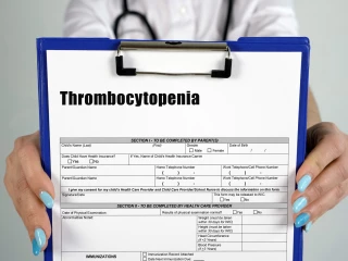 immune thrombocytopenia2