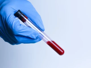 Jednohubky z klinického výzkumu – 2025/36