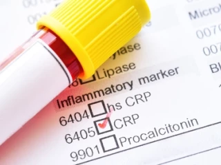 biomarker