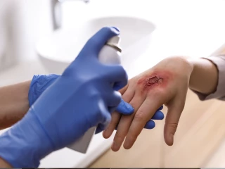 debridement09