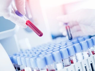 laboratorní vyšetření krve