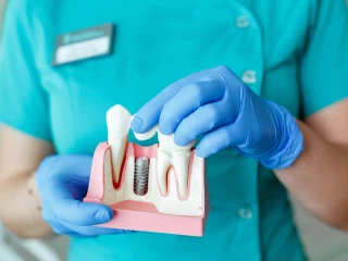 zubní implantáty