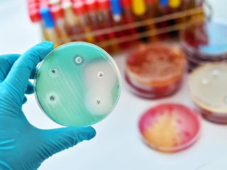 Antibiotika_lecba_test