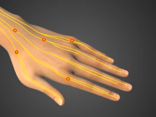 Neurobion ruka