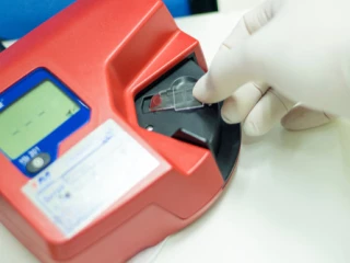 poct_analyza_pristroj_diagnostika_krev_ambulance