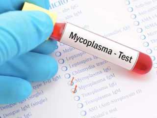 mycoplasma test