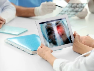 Plíce_snímek_tablet_lékaři