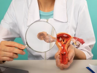 ovaria cancer