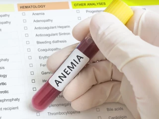 Anemia therapy