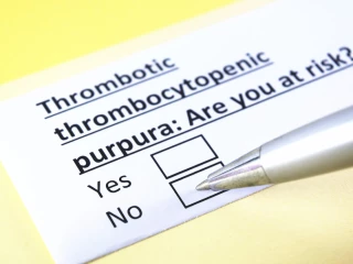 trombocytopenická purpura