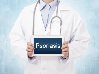 PSORIASIS