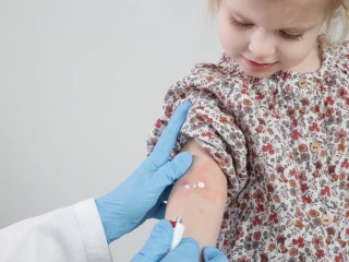 Atopická dermatitida děti_holčička