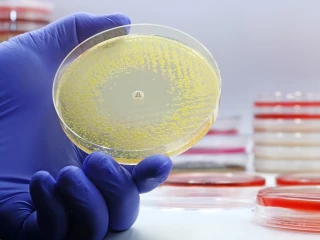 antibiotika resistence
