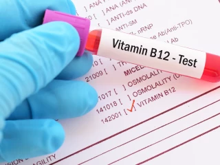 B12