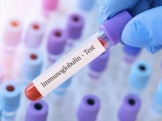 imunoglobulinem G (IgG)