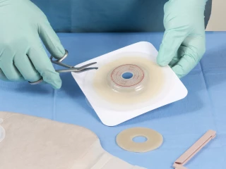 stoma pomucky