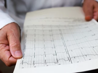 ECG reading 2025