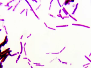 zdroj: http://freerangestock.com/
