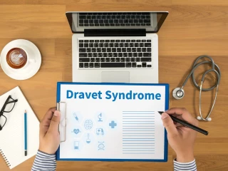 syndrom Dravetové
