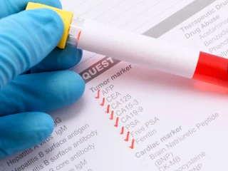 testování biomarkerů