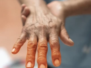 diabeticka_neuropatie_ruce