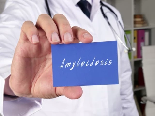 Hereditární transthyretinová amyloidóza 2