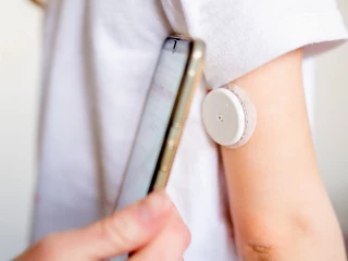 CGM diabetes