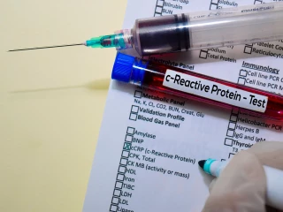 C-reaktivní protein