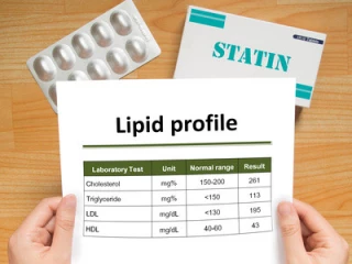 statin_lipidy_statiny