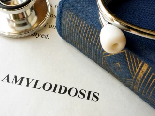 amyloidosis