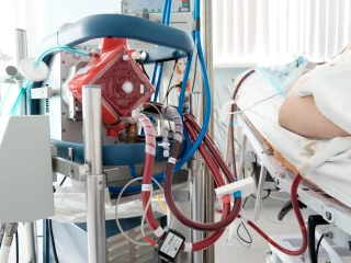 ECMO