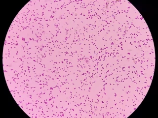 Stabilní citlivost E. coli a E. faecalis k nitrofurantoinu − srovnání regionálních antibiogramů