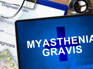 myastevia gravis