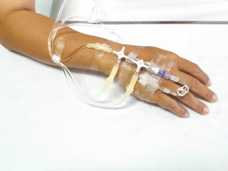 chemoterapie teva péče