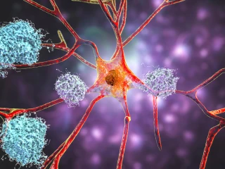 amyloid