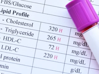 lipidy_studie