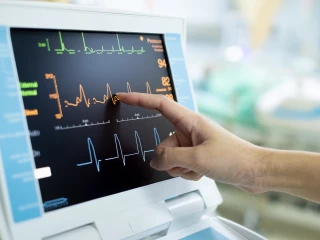 EKG monitor amyloid