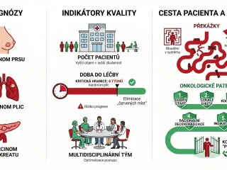 Ministerstvo zdravotnictví otevřelo data ke třem onkologickým diagnózám