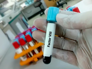 faktor VIII hemofilie krev zkumavka