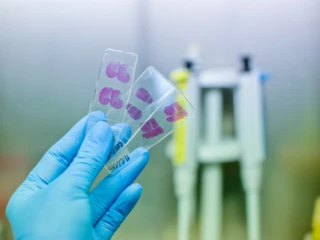 histologie_genetika_onkologie