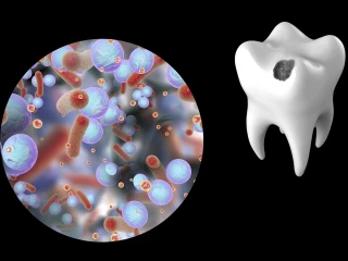 Streptococcus mutans