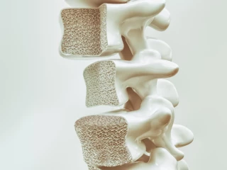 Diagnostika osteoporózy v kontextu současných doporučení