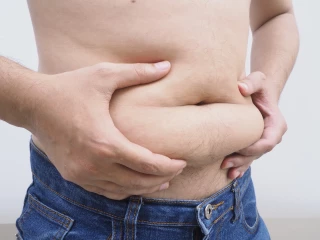 Obezita 1