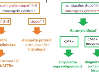 infografika amyloidoza