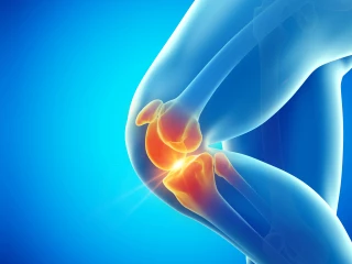 osteoartróza kolene