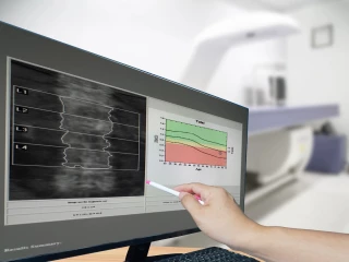Osteoporoza monitor