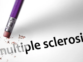 multiple sclerosis