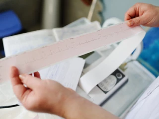 ekg_mereni_kardio_srdce