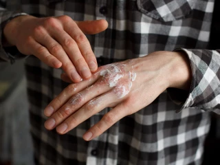emoliencia_atopická dermatitida