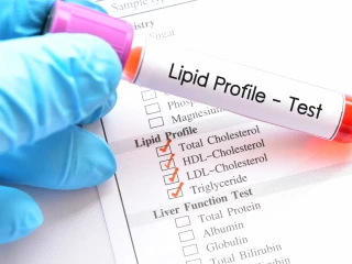 Dyslipidemia